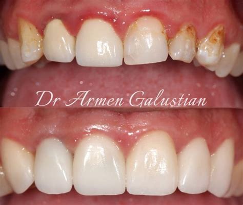 periodontics near me|periodontist near me reviews.